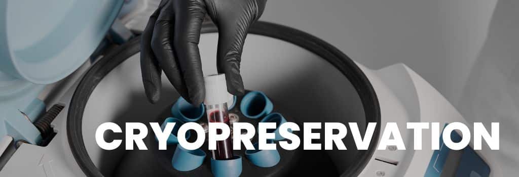 Cryopreservation in Delhi NCR | Fertijoy IVF Center