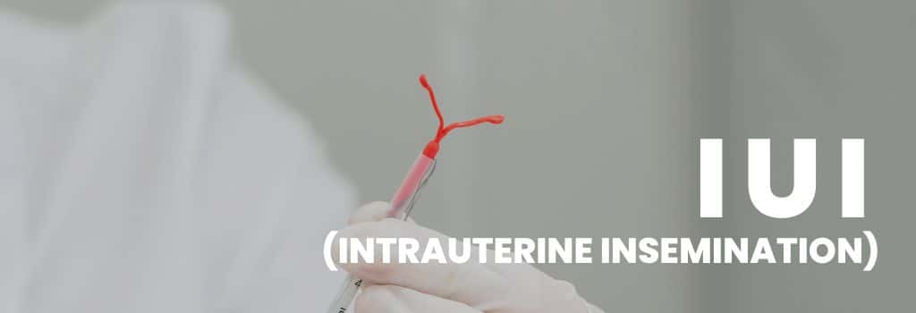 IUI Treatment in Delhi NCR | FertilityJoy IVF Centre