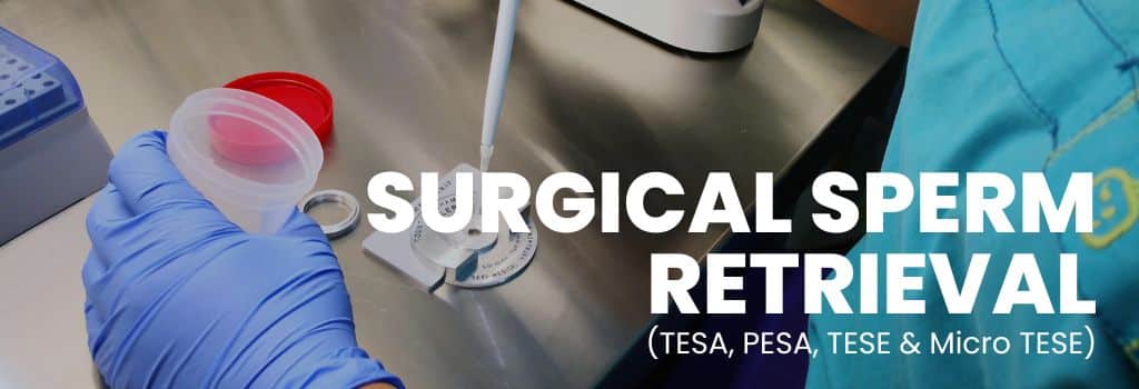 Surgical Sperm Retrieval (TESA, PESA, TESE, Micro TESE) in Delhi NCR | Fertijoy IVF Center