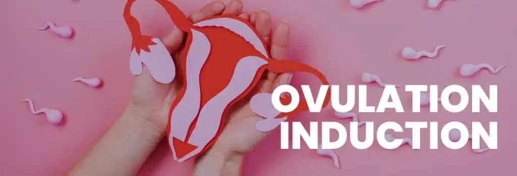 Ovulation Induction Treatment